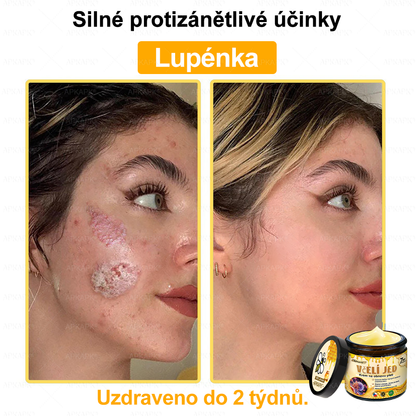 Dermatologicky a klinicky testováno👩‍⚕️👩‍⚕️APKAPK®Bee Venom Krém na obnovení pleti🐝 pomáhá při léčbě kožních problémů, jako jsou: vrásky, jizvy, pigmentové skvrny, strie, akné, psoriáza, ekzém, kožní změny, podráždění, záněty a další kožní problémy. 👩‍⚕️