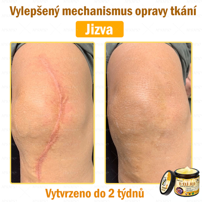 Dermatologicky a klinicky testováno👩‍⚕️👩‍⚕️APKAPK®Bee Venom Krém na obnovení pleti🐝 pomáhá při léčbě kožních problémů, jako jsou: vrásky, jizvy, pigmentové skvrny, strie, akné, psoriáza, ekzém, kožní změny, podráždění, záněty a další kožní problémy. 👩‍⚕️