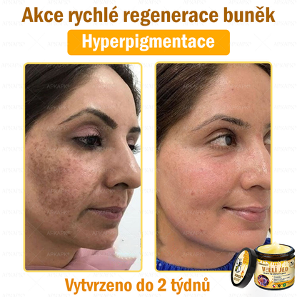 Dermatologicky a klinicky testováno👩‍⚕️👩‍⚕️APKAPK®Bee Venom Krém na obnovení pleti🐝 pomáhá při léčbě kožních problémů, jako jsou: vrásky, jizvy, pigmentové skvrny, strie, akné, psoriáza, ekzém, kožní změny, podráždění, záněty a další kožní problémy. 👩‍⚕️
